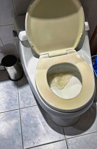 https://blockeddrainskinross.com.au/uploads/2025/07/blocked-toilet-27293.jpg